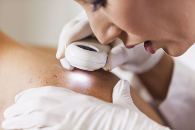 Dermatologist conducting a skin test.